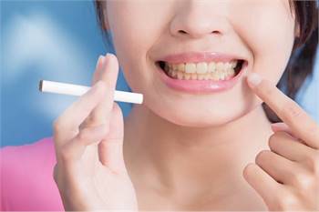 5 Ways In Which Smoking Damages Your Oral Health